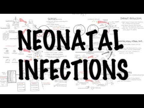 Infections néonatales - synthèse