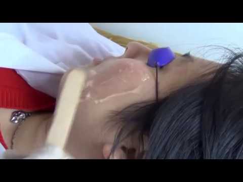 Askorutin da lentiggini Quello che dice posti di pigmentary sopra un labbro superiore su