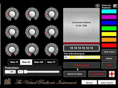 Артроз коленного сустава -Радионика-Познавательный Влог