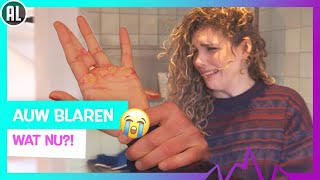 HOE VERZORG JE BLAREN?! | TOPDOKS EERSTE HULP BIJ TIKDOKS