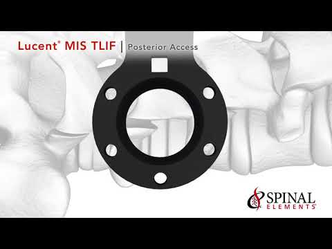 Spinal Elements: Lucent MIS TLIF