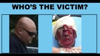 TRAYVON MARTIN ATTACK #2?