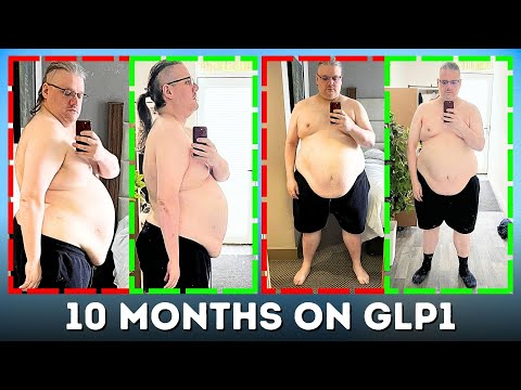 10 Months on Mounjaro Before and After Results // REAL Weight Loss Journey