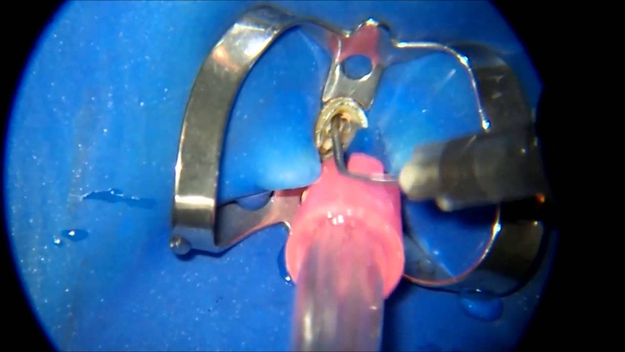 Rodrigo Vosiacki Rossi-16