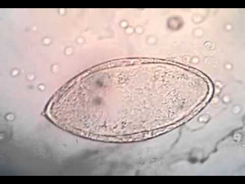 Se è possibile mangiare prima di consegna un calla su helminths Se è dannoso per vermi del corpo umani