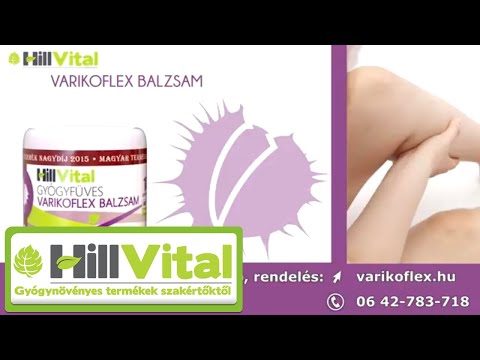 visszér és ülő munka a számítógépnél kenőcsöt rendeljen a visszerekből