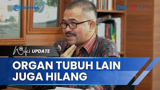Sebut Pankreas dan Kantung Kemih Jenazah Brigadir J juga Hilang, Kuasa Hukum: Masih Jadi Misteri!