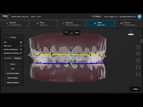 Spline Tool