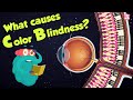 What Causes Color Blindness? | WhatIs COLOR BLINDNESS? | Dr Binocs Show | Peekaboo Kidz