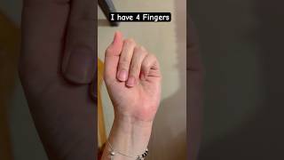 I have only 4 Fingers😇🥳 #funny #shorts #shortvideo #comedyshorts