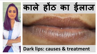 dark lips treatment by dermatologist