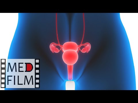 Акушерские кровотечения при гипотонии матки © Obstetric hemorrhage with hypotension uterus