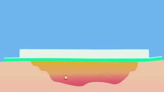 Cutimed Sorbact Hydroactive absorption