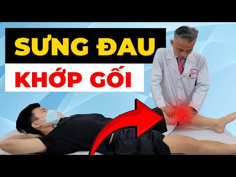 Sưng Đau Khớp Gối Sau Mổ Dây Chằng? Cách Phục Hồi Nhanh Gấp 3 Lần