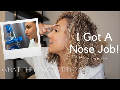What They Don't Tell You About Rhinoplasty | My Experience & Recovery With My Nose Job