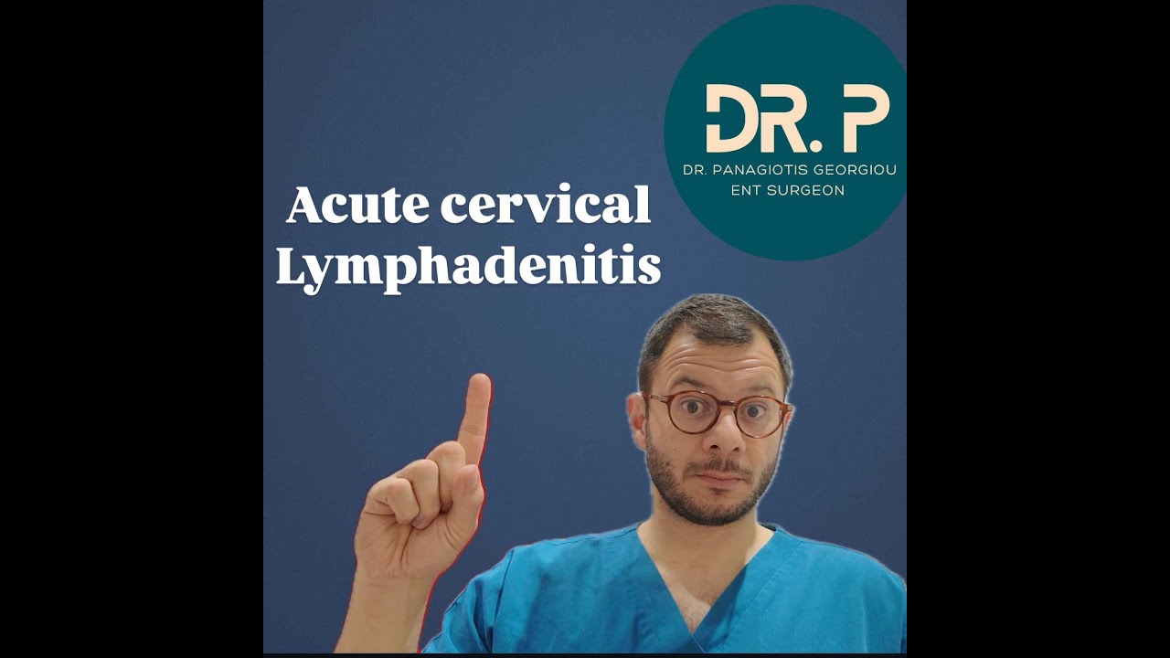 Acute Cervical lymphadenitis Everything you need to know!