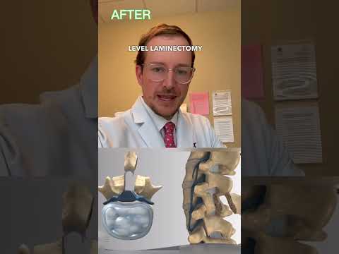 🔄 Thigh Weakness REVERSED 🔄