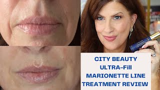 DIMINISH MARIONETTE LINES WITHOUT NEEDLES BEAUTY OVER 50