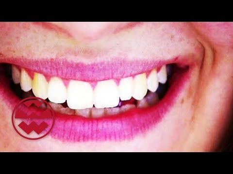 Weiße Zähne: Bleaching-Produkte & Co. im Test - Welt der Wunder