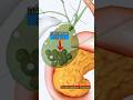 Gallbladder Stones 3D Animation |Medical| #3d #medical