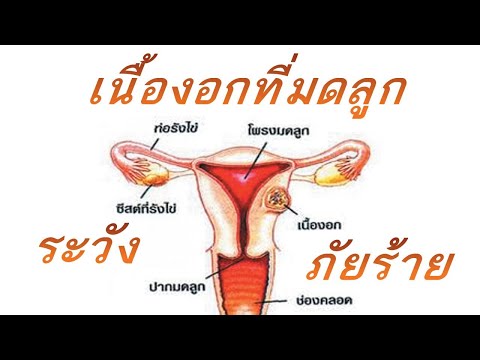 สมาชิกเล็ก ๆ ของทีมรัสเซียคอร์ด กระตุ้นแรงชาย