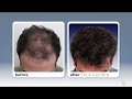 The Hair Loss Doctors | New York,  NY
