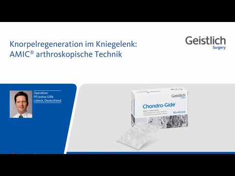 Koenig-Krankheit des Knies behandelt mit Volksmedizin Bewertungen Spärliche Menstruation mit Rückenschmerzen