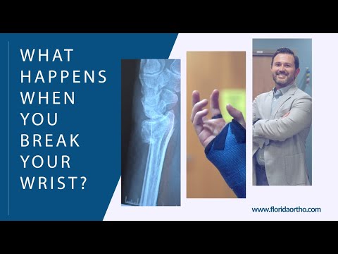 What Happens When You Break Your Wrist? - Florida Orthopaedic Institute
