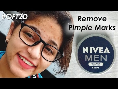 How to Remove Pimple Marks पिम्पल्स के धब्बे कैसे हटाये Nivea Men Dark Spot Cream Review #OFT2D Video