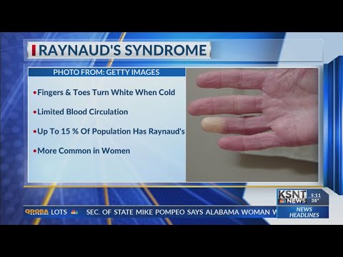White, blue fingers may mean more than a sign of cold weather