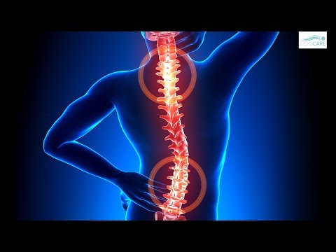 Non riesco a starnutire a causa del mal di schiena Scricchiolii articolazioni del ginocchio in un bambino