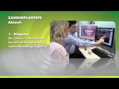 Praxis Dr. Erhard - Implantate