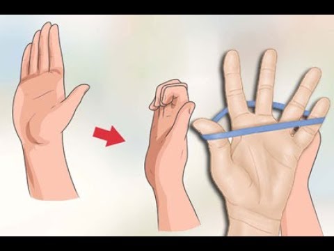 Die Schuppenflechte auf der Hand beim Mann Die Unfruchtbarkeit bei der Schuppenflechte