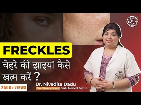Freckles Treatment