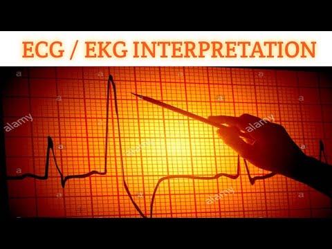 ECG/EKG Interpretation part 3 / Cardiac Axis or Axis Deviation in ECG