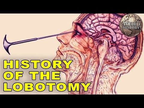 Walter Jackson Freeman II The Champion Of The Lobotomy