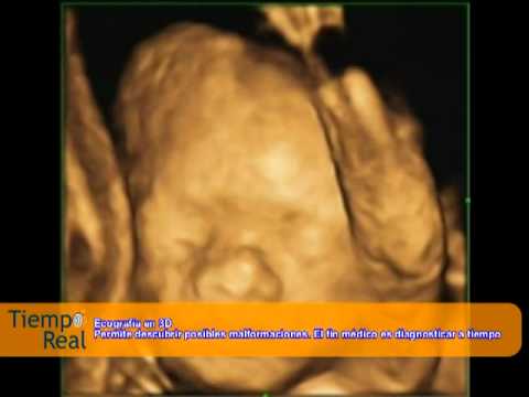 Apparecchiatura per il trattamento di ginocchio congiunto di prezzi Spalla plexitis farmaci trattamento sintomi articolari