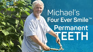 The Stigma of Losing Your Teeth │Four Ever Smile™