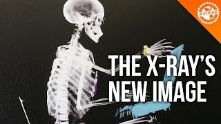 The World's Smallest X-Ray Machine