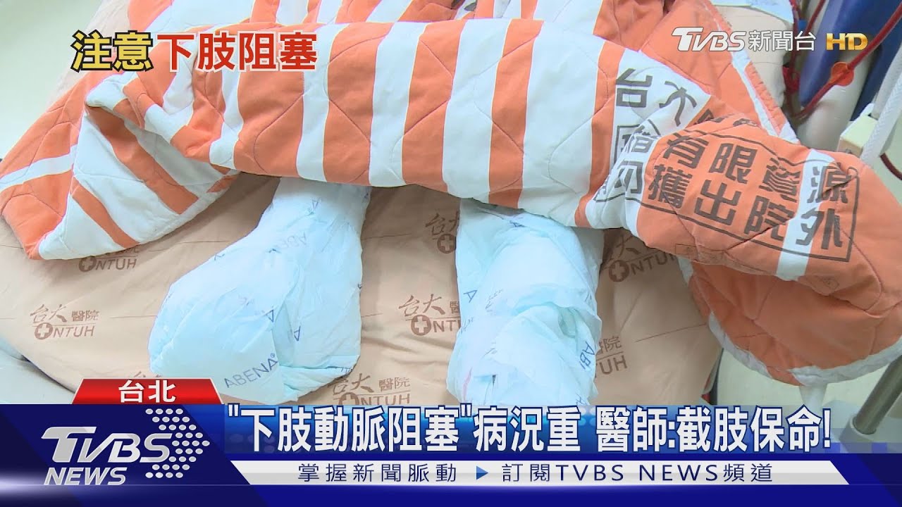 腳冰冷、腳麻、疼痛 「下肢動脈阻塞」若輕忽「恐截肢」