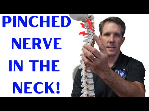 7 Signs and Symptoms of a Pinched Nerve in the Neck