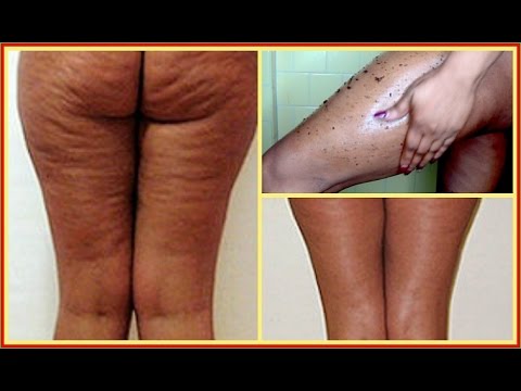 Pagsasabwatan upang slimming waning moon Postpartum paano alisin ang taba ng tiyan pag-eehersisiyo video