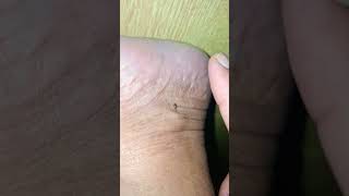 Download lagu pagi pagi masih ada nyamuk #feedshorts #youtubeshorts #nyamuk #mosquito mp3