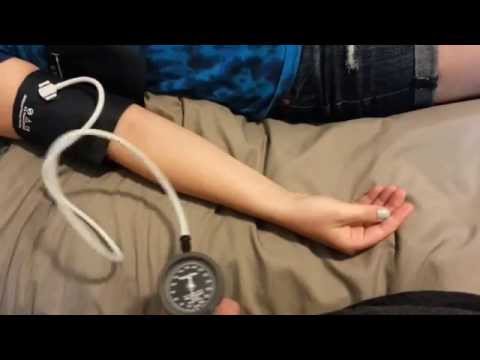 Trousseau's Sign of Hypocalcemia