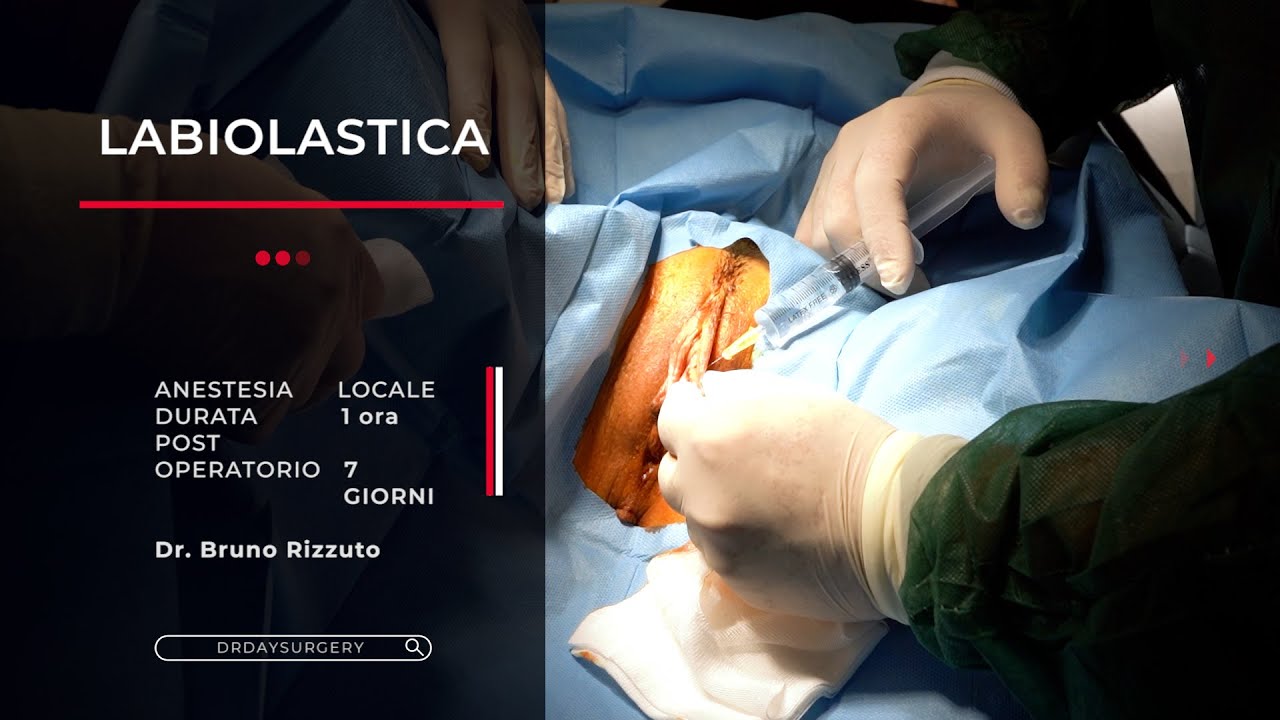 LABIOPLASTICA - Intervento di Chirurgia Estetica Intima