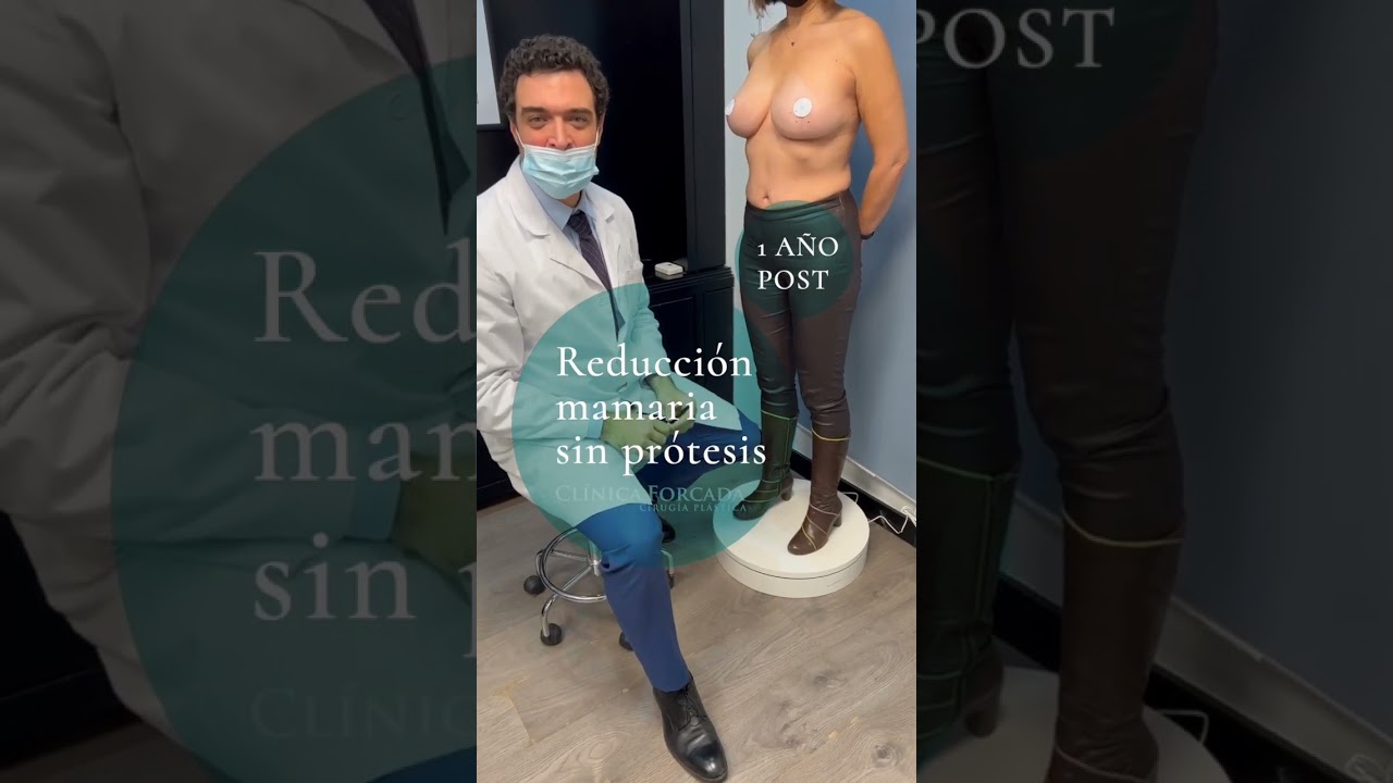 Watch Reducción mamaria un año después Now Reducción mamaria un año después