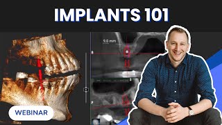 Implants & CBCT 101: Master the Basics