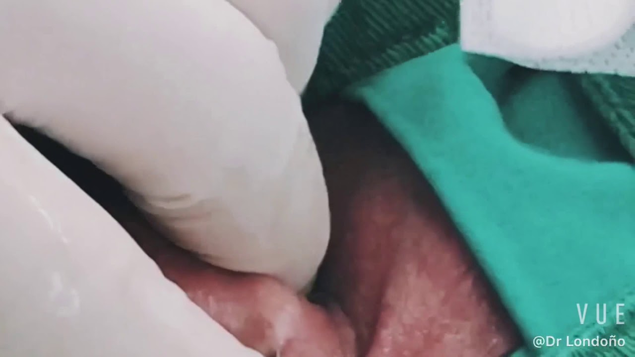 Carlos Londoño Martínez-21