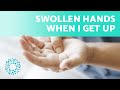I Have SWOLLEN HANDS in the MORNING ✋ (8 Causes of Hand Swelling)