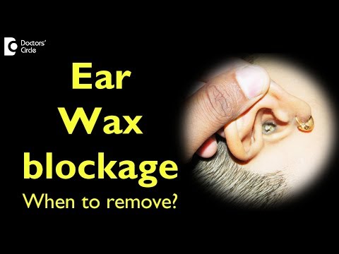 Ear Wax blockage - When to remove? - Dr. Sheelu Srinivas